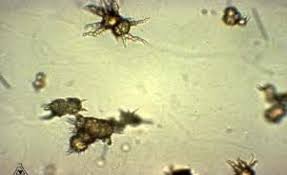 Ammonium Biurate Crystal Medical Laboratory Scientist Medical Laboratory Crystals