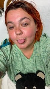 I had a lap and revision to a gastric bypass