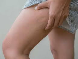 Birthmark On Leg Meaning In Hindi What Having Birthmark On These Parts Of Your Body Really Means The Times Of India