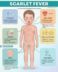 Image result for Scarlet Fever