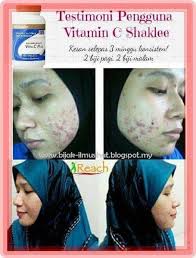 May 17, 2021 · kaya dengan vitamin c, pencuci muka ini ternyata mampu mencerahkan muka secara efektif jika digunakan secara konsisten. Kebaikan Vitamin C Kecantikan Vitamin Kulit