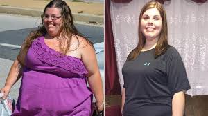 Read this before you sign up! Doctor Finds Cancer During Prep For Gastric Bypass Surgery Abc News