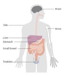 29.03.2018 · when a lymphoma starts in the skin, it is called a skin lymphoma (or cutaneous lymphoma ). Lymphoma Wikipedia