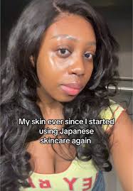 From dry and crusty to reflective! And my breakouts are reducing 🫶🏾  #japaneseskincare #japaneseskincareroutine #jbeauty #glowingwithmary