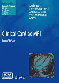 Image result for Cardiac MRI
