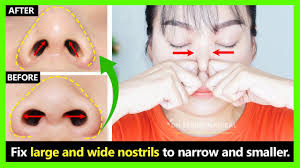 İngilizce türkçe online sözlük tureng. Fast Result How To Fix Big Wide Nostrils To Be Narrow Smaller With Nose Exercise Massage Youtube