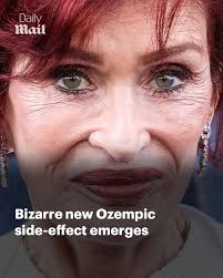 Stars are all showing the telltale sign 😯 Read more:  https://trib.al/yPZRJG2