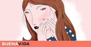 Fotorrelato Los Seis Tipos De Granos Que Distinguen Los Dermatologos Y Como Tratarlos Buenavida El Pais