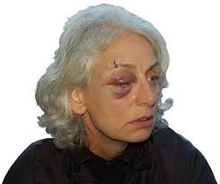 Carlisle police officer recommended for top honour for helping catch thug  who viciously assaulted her