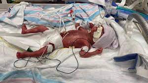 For Every Mom - He was supposed to be stillborn...every... | Facebook