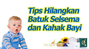 Guna menghilangkan dahak, kamu bisa memilih obat batuk yang memiliki kandungan ekspektoran. Cara Hilangkan Selsema Bayi Dengan Baby Balm Tok Syed Youtube