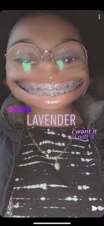 Black And Purple Braces Color Purple Braces Braces Colors Braces Teeth Colors Cute Braces