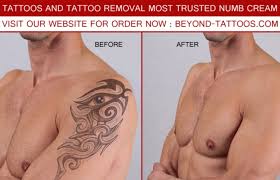 Icy hot max strength pain relief cream. Dr Numb Cream For Pain Free Laser Tattoos Removal Islamabad