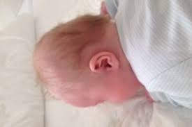 Ich habe nur gehört innerhalb des ersten jahres. Bauchliegen Flacher Hinterkopf Babydorn Ratlos Urbia De