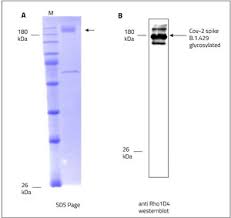 Analysis of samples from maharashtra had revealed that compared to december 2020, there was an increase in the fraction of samples with the e484q and l452r mutations. ã¨ã ã¨ã¹ãã¯ãã·ã¹ãã ãº Sars Cov 2 æåã¿ã³ã'ã¯è³ª