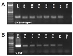 Image result for CSF PCR