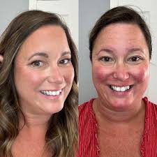 It's Makeover Monday and this is one of my faves to share!! How great is  her coverage with Seint••• -Walnut Contour for Redness & Eczema Correction  -Sunlit for under eye correction -Amber