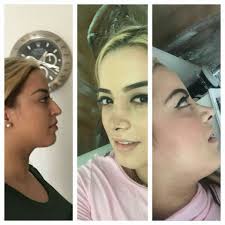 Diana Cuartas/salud y belleza.