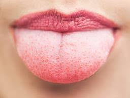 Cutting off swollen taste buds. Swollen Taste Buds Causes Diagnosis And Treatment
