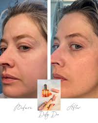 🫶🏼Skincare that gives a sh*t about You! (@alaglowskincare) • Instagram  photos and videos