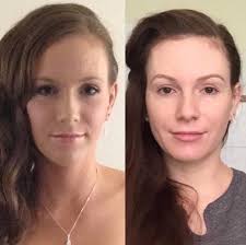 If you are like most people, you may not give… How To Sleep After Wisdom Teeth Removal Reddit Teethwalls
