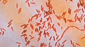 A salmonella sample can be obtained directly from the patient (feces) or from contaminated water/foods. How Typhoid Mary Left A Trail Of Scandal And Death Bbc News