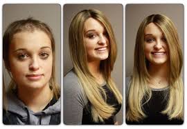 It is done in private and is often times denied by the sufferer and hidden from others including loved ones. Kim Lake Hair Extensions Federal Way