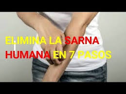 Se estima que la sarna infecta a más de 300 millones de humanos en todo el mundo cada año, incluido 1 millón de personas en los estados unidos. Como Eliminar La Sarna Humana Remedios Contra La Sarna Humana Escabiosis Youtube Escabiosis Recetas Para La Salud Sarna