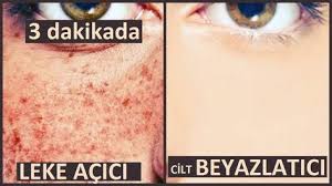 3 Dakikada Gunes Lekelerini Yok Et Cilt Beyazlatici Dogal Maske Guzellik Bakim Bayram Hediyesi Youtube Yuzler Maskeler Guzellik