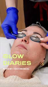Another heartwarming entry in our Glow Diaries series 🩵 this time for our  lead aesthetician and director of aesthetic development, Ashley Powers! ✨,  #patienttestimonial #SpaDerma #Moxi #BBLHeroic ...