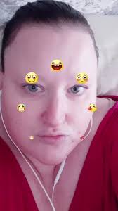 Mary Roberson Va Seizures