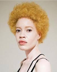 african american model with albinism breaks barriers to expand the definition of beauty albino model albinism albino african