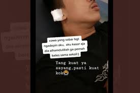 Should you be afraid of tiktok? Soal Video Viral Pria Yang Terluka Karena Kekasihnya Ini Penjelasan Psikolog Halaman All Kompas Com