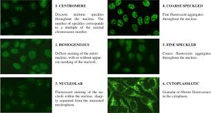 Image result for ANA Staining Pattern