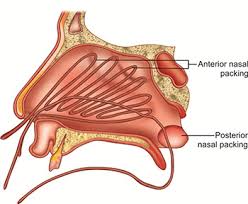 In acute vestibulitis, the skin is red, swollen and tender. Jaypeedigital Ebook Reader