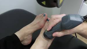 Non Surgical Mls Laser Treatment North Austin Foot Ankle Institute