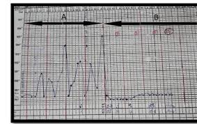 temperature chart of the patient a meropenem b co