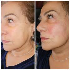 BLK Beauty Clinic and Training Academy