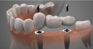 We value your business and do the best we can to help you with your needs. Dental Care Pomotions Smiles At Doral Dentist Office Doral Fl