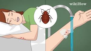 We did not find results for: How To Treat Bed Bug Bites 12 Steps With Pictures Wikihow