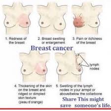 If you gently press on the armpit, you will potentially feel tender there, dr. Breast Cancer Signs Beauty And The Mist