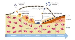 Bone remodeling is a continuous and balanced process of bone resorption by osteoclasts and bone formation by osteoblasts. Bone Remodeling Platforms Understanding The Need For Multicellular Lab On A Chip Systems And Predictive Agent Based Models
