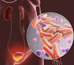 Vacuna Para Prevenir Las Infecciones De Orina Tu Canal De Salud