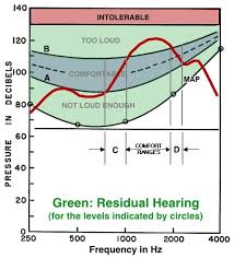 Otometry Basic Concepts Wayne Staab Phd