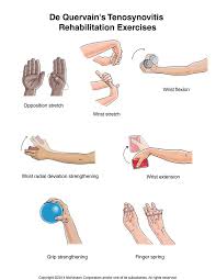 Sakit Pergelangan Tangan Ibu Jari 5 Perkara Tentang Dequervain S Tenosynovitis Mama Perlu Tahu