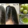 Amla oil is a natural oil used for hair health that contains extracts from the indian gooseberry amla oil can easily be sourced online and is found in many stores specializing in natural foods or ayurvedic. 1