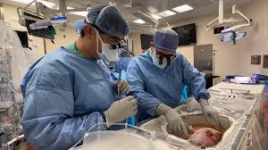 Image result for Transplantation