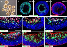 Maybe you would like to learn more about one of these? Organization Of A Distinct Ganglion Cell Layer Within Retinal Download Scientific Diagram