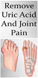 Pin On Bunions Uric Acid