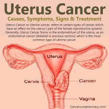 The risk factors of uterine cancer depend on the type but generally, factors such as older age, obesity, human. Breast Cancer And Cervical Uterus Cancer Health Nigeria